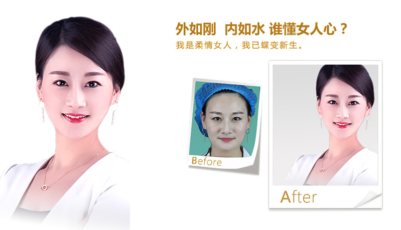 南京V脸、线雕隆鼻
